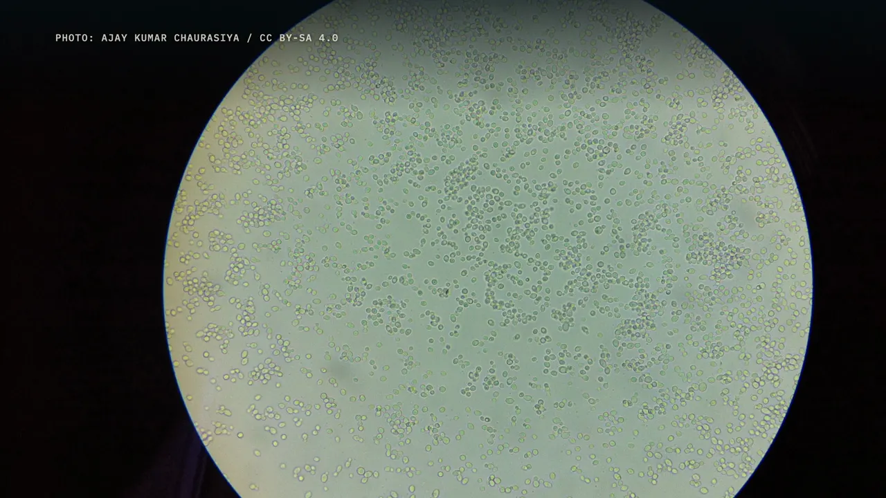 Die Waffe der Hefe und die Hürden